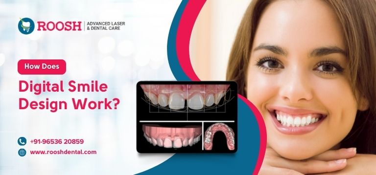 How Does Digital Smile Design Work?