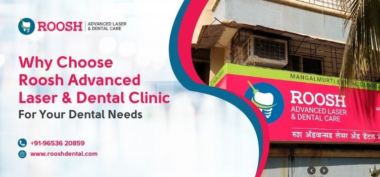 Why Choose Roosh Advanced LASER & Dental Clinic for Your Dental Needs